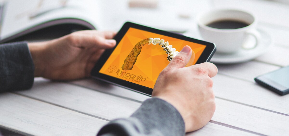 Incognito™ Appliance System Means Digital Workflow